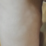 [19] 울퉁불퉁한거 지방<b>흡입</b>한거임??