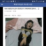 [<b>19</b>] 병원가서 ㄸ꼬 뚫은 <b>썰</b>