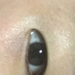 [댓글부탁해] <b>약약</b>혐주의)주변에서 쌍수 하지 말라면 안하는게 좋아...