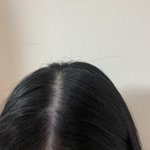 [댓글부탁해] 얘들아 나 <b>탈모</b>같냐