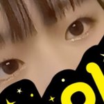 이런 눈 쌍수하면 <b>망해</b>? ㅈㅂ 댓좀부탁햅ㅜㅜ