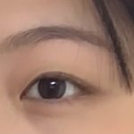 쌍수 상담 후기