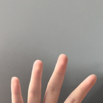 살 빼면 손가락 살도 저절로 빠짐ㅠㅠㅠ??