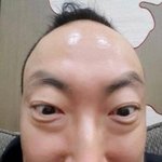 내 이마 너무 <b>볼록</b>한것같음?