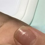 [댓글부탁해] <b>손톱</b>바디가짧고 노란부분이 길어서