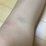 약혐) 너네 진짜 누워있다가 벌떡 일어나지마