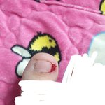 [혐주의] 혐!어제 <b>발톱</b> 덜렁거리는거 뜯었다가 피 개많이남