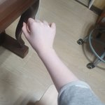 나 백혈병걸린거같음