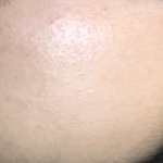 내 피부 <b>가망</b> 없음? (사진 주의)