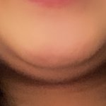 나 <b>턱살</b> 어떡해