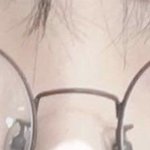 쌍수 성공케이스는 나다 애듷아 용된게 먼지 보여줌