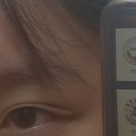 [댓글부탁해] 나 쌍커풀 만드려고 눈에 테이프 <b>붙임</b>