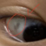 나 <b>눈알</b>에 점있는데 볼사람