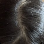 [19] 나머리 <b>탈모</b>야?????