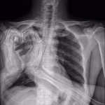 [방탄소년단] 준아