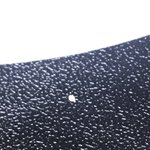 [19] 헐 내가 <b>치석</b> 스스로 떼어냈음