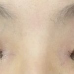 야 나 쌍수 라인 봐주삼 ㅠㅠㅠ짝눈임?