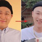 나 ㄹㅇ 다이어트 했는데도 못생김