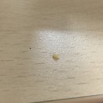 약혐주의) 와 나 <b>피지</b> 뽑은거 개큼