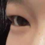 [댓글부탁해] 나보다 <b>눈두덩</b>이 살 많은애 있니 진짜ㅠㅠ