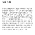 나 그 <b>코난</b>에 뭉치 수술해주는 꿈 꿨음