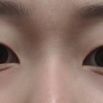 <b>쌍수</b>하면 망하는 눈이 따로 있어?