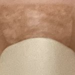 [댓글부탁해] <b>쌍수</b> 3일차인데 괜찮음?