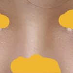 [댓글부탁해] 나 다크<b>서클</b> 심한 편이냐?