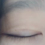 이거 쌍수<b>자국</b> 심한거냐