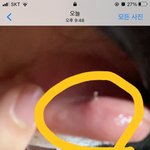 얘드라 귓바퀴 이래됬는데 어캄 망함