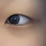 이런 눈은 쌍수 하면 망함???ㅠㅠㅠ