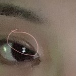 얘들아 여기 쌍수 붓기 빠질 거 같아(???
