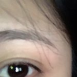 쌍수 <b>부기</b> 더 빠져 여기서??