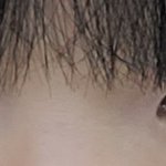 쌍수한지 3주 됐당