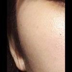 [댓글부탁해] <b>교정</b>한 친구들아.. 얼굴형 어떡하냐