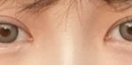[드루와] 쌍수재수술 ㅈㄴ 하고싶은데