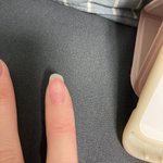 <b>손톱</b> 바디 찢어졌는데 다시 자랄 거 같냐 봐바