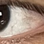 [드루와] <b>눈알</b> 나보다 드러운 사람?