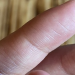 [꼭조언부탁] 손톱 <b>피날</b>때까지 물어뜯는 사람 정신적으로 불안정해보이나요