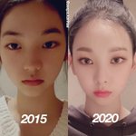 이거 눈 뭐 한걸까??