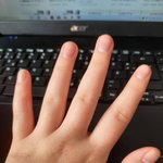 손톱 조카 짧게 <b>자름</b>