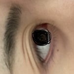 이런 눈 쌍수해야되나???
