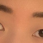쌍수할까 말까