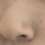 얘들아 나 피부 왜 이래ㅜㅠ?