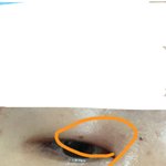 [드루와] 이거 다래끼 <b>각임</b>?.....