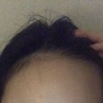 [드루와] 내 헤어라인 비대칭 실화냐?ㅅㅂ