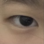 쌍수하면 망할 눈임?