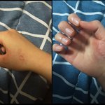 [진격의거인] <b>에렌</b>예거 거인화 어떻게 하는거임 ㄹㅇ...