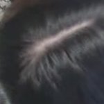 나 <b>탈모인</b>거 같아?