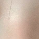 나 쌍수하면 망할 눈인가